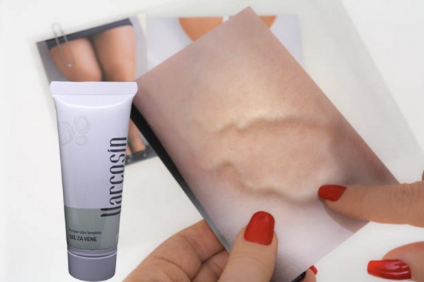 Varcosin Fiyatı ve Türkiye – Nereden Alınır – Resmi Web Sitesi Varcosin Fiyatı ve Türkiye – Nereden Alınır – Resmi Web Sitesi