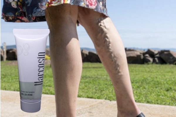 Varcosin nedir? Varcosin varisli damarlar için